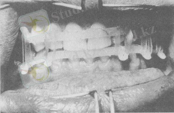 http://konspekta.net/medlecbazaimg/64884879784.files/image039.jpg