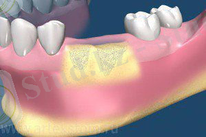 http://inno-stom.ru/d/1154069/d/1846117621_6.jpg