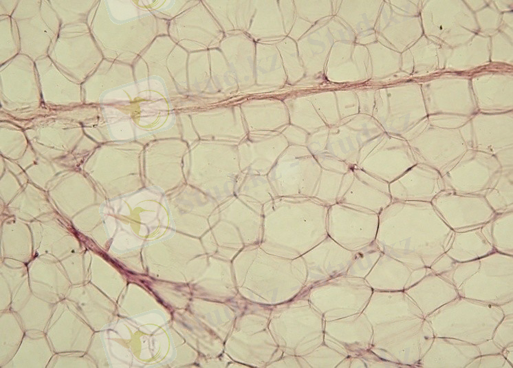 C:\Users\User\Desktop\Yellow_adipose_tissue_in_paraffin_section_-_lipids_washed_out.jpg