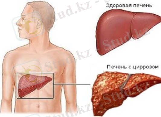 https://chebo.pro/wp-content/auploads/428111/fullsize.jpg
