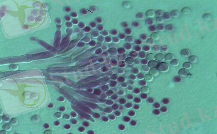 http://ecoenergy.org.ua/wp-content/uploads/2018/03/Penicillium-glaucum-e1513370365305.jpg